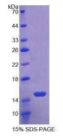 Toll样受体3(TLR3)重组蛋白