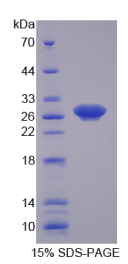 周期素依赖性激酶16(CDK16)重组蛋白