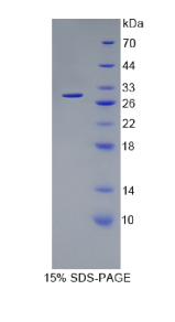 非ATP酶蛋白酶体26S亚基10(PSMD10)重组蛋白