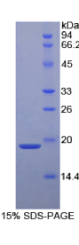 α2-纤溶酶抑制因子(α2PI)重组蛋白