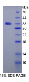 转化生长因子β受体Ⅲ(TGFβR3)重组蛋白