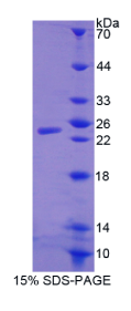 WAP四二硫化物核心域蛋白1(WFDC1)重组蛋白