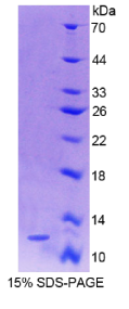 S100钙结合蛋白A4(S100A4)重组蛋白