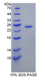 成纤维生长因子受体底物2(FRS2)重组蛋白