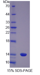 S100钙结合蛋白A8(S100A8)重组蛋白