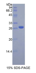 成纤维细胞生长因子受体样蛋白1(FGFRL1)重组蛋白