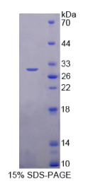 TNF受体关联因子6(TRAF6)重组蛋白