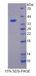 白介素12B(IL12B)重组蛋白