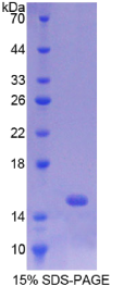 p53上调凋亡调节因子(PUMA)重组蛋白