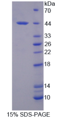 白介素12B(IL12B)重组蛋白