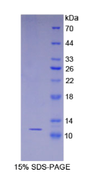 S100钙结合蛋白A8(S100A8)重组蛋白