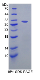 GRB2关联结合蛋白2(GAB2)重组蛋白