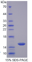 CD7分子(CD7)重组蛋白