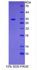 B-细胞淋巴瘤因子3(Bcl3)重组蛋白