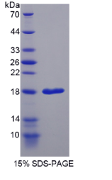 再生胰岛衍生蛋白1α(REG1α)重组蛋白