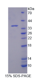 动力蛋白胞浆1重链1(DYNC1H1)重组蛋白