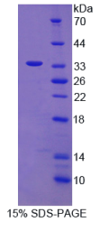 白介素1β(IL1β)重组蛋白