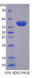 半乳糖凝集素4(GAL4)重组蛋白