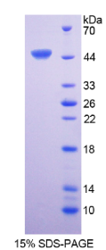 白介素6(IL6)重组蛋白