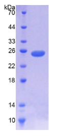 NODAL调节因子1(NOMO1)重组蛋白