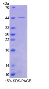 Snurportin 1蛋白(SNUPN1)重组蛋白