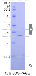 β-位淀粉样前体蛋白裂解酶1(βACE1)重组蛋白