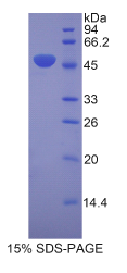 层粘连蛋白γ2(LAMγ2)重组蛋白