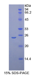 α1-微球蛋白(α1M)重组蛋白