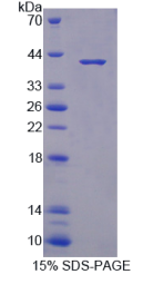 S100钙结合蛋白A10(S100A10)重组蛋白