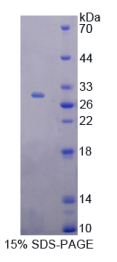 T-框蛋白21(TBX21)重组蛋白