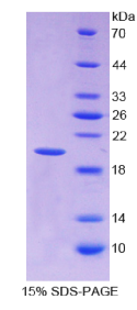 白介素1β(IL1β)重组蛋白