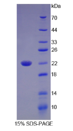 白介素17B(IL17B)重组蛋白