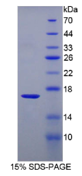 T-细胞白血病/淋巴瘤蛋白1A(TCL1A)重组蛋白