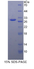 白介素27受体α(IL27Rα)重组蛋白