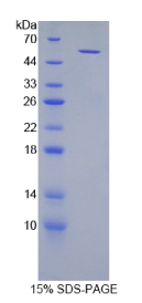 TGFβ诱导早期应答基因1(TIEG1)重组蛋白