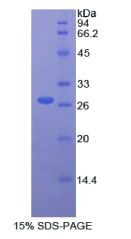 成纤维生长因子受体底物2(FRS2)重组蛋白