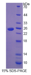 γ-谷氨酰基转氨酶5(γGT5)重组蛋白