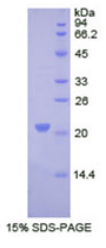 Ⅷ型胶原α1(COL8α1)重组蛋白