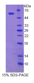 Nicastrin蛋白(NCSTN)重组蛋白