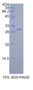 Zeste同源物增强子2(EZH2)重组蛋白