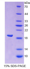 Ⅷ型胶原α1(COL8α1)重组蛋白