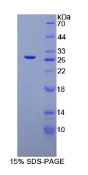 转化生长因子β1诱导转录因子1(TGFβ1I1)重组蛋白