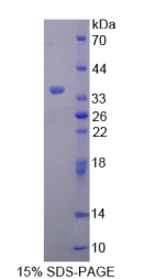 促泌素(SCGN)重组蛋白