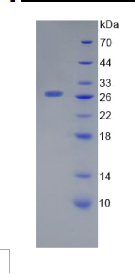 半乳糖凝集素12(GAL12)重组蛋白