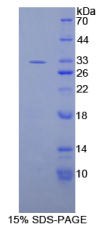 白介素20受体β(IL20Rβ)重组蛋白