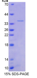 转化生长因子β刺激蛋白22(TSC22)重组蛋白