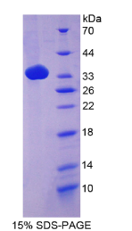 补体成分4(C4)重组蛋白