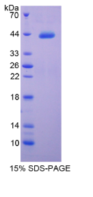 补体成分4(C4)重组蛋白