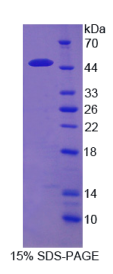 再生胰岛衍生蛋白1α(REG1α)重组蛋白