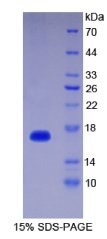 白介素1δ(FIL1δ)重组蛋白